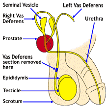 Anatomical Diagram of the Vas Deferens for Vasectomy
